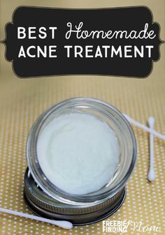 Best Homemade Acne Treatment - Do you suffer from acne? This natural remedy for acne not only zaps zits quickly, but it also soothes and moisturizes the skin. Next time you suffer from a breakout, skip those drugstore products loaded with chemicals and unnatural ingredients and opt to make this homemade acne spot treatment. Remedy For Acne, Drugstore Products, Acne Spots