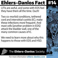 Eds Facts, Ehlers Danlos Syndrome Symptoms, Elhers Danlos Syndrome, Mast Cell Activation Syndrome, Chronic Fatigue Symptoms, Chronic Migraines