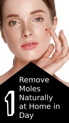 Easy Way to Remove Moles Naturally at Home in One Day Remove Moles Naturally, Natural Mole Removal, Instant Migraine Relief, Facial Mole, Nose Picking