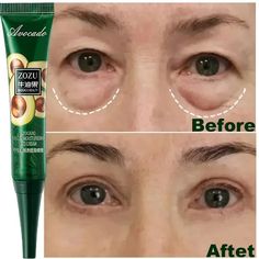 7 Day Tighten Wrinkles Eye Cream Anti Dark Circles Bags Puffiness Fade Tighten Under Eye Skin, Avocado Eye Cream, Avocado Beauty, Eye Wrinkle Cream, Eye Skin Care, Facial Wrinkles, Remove Dark Circles, Dark Circles Under Eyes, Eye Wrinkle