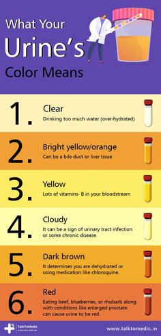 What The Color Of Your Urine Says About Your Health!!! - Susan Miller - Medium Pee Color, Color Of Urine, Urine Color, Color And Meaning, Liver Issues, Reflexology Chart, Shingle Colors, Mixed Drinks Alcohol, Bile Duct