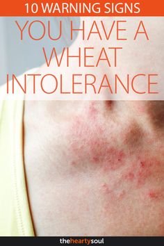 Wheat Intolerance Symptoms, Gluten Symptoms, Celiacs Disease, Wheat Alternatives, Gluten Intolerance Symptoms, Wheat Allergy, Wheat Free Bread, Gluten Bread