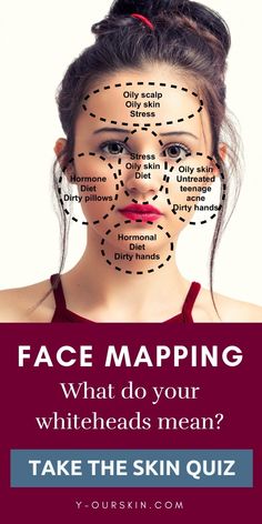 Gesicht Mapping, Face Map, Beauty Bible, Skin Diet, Aesthetic Studio, Face Mapping, Brown Spots On Face, Menstrual Health