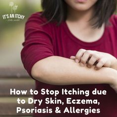 How to Stop Itching due to Dry Skin, Eczema, Psoriasis & Allergies How To Stop Itchy Skin, Itching Remedies Skin, Itching Skin Remedies, Cheryl Cochran, Itching Remedies, Itchy Skin Remedy, Dry Hand Skin, Skin Hacks, Dry Skin Routine