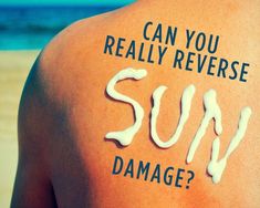 Can You Really Reverse Sun Damage Heat Safety, Essential Oil Anti Aging, Sunburn Relief, Moisturizer For Oily Skin, Anti Aging Moisturizer, Anti Aging Tips, Anti Aging Cream, Foto Inspiration