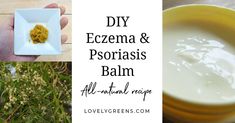 Lovely Greens, Easy Soap Recipes, Diy Herbal Remedies, Inflamed Skin, Homemade Face Cream, Auto Immune, Healing Balm, Skin Natural Remedies