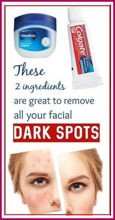 Age Spots On Face, Vaseline Petroleum Jelly, Dark Spots On Face, Brown Spots Removal, Tongue Health, Brown Spots On Face, Dark Spots On Skin, Spots On Face, Remove Dark Spots