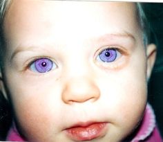 a young child with blue eyes looking at the camera