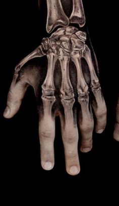 a skeleton hand is shown in black and white, with the bones visible on it