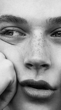 a black and white photo of a woman with freckled hair holding her hands to her face