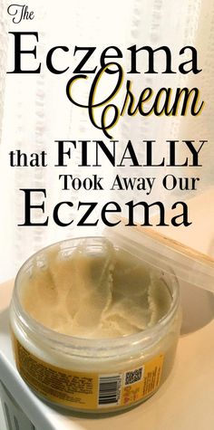 Nothing is worse than chronic eczema that just won Best Anti Aging, The Cream, Herbal Remedies, Organic Skin Care, Baking Soda, Aloe Vera, Salt, Lounge, Skin Care