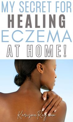 So, this is the story about my battle with eczema (which tried to ruin my childhood), and how I finally learned to treat it!At age 8, I was sitting outside on the step of my grandmothers house in Coastal Georgia. I remember a very small scratch on my left leg. Hmmm this looks a "ring Ruin My Childhood, Atlanta Lifestyle, Coastal Georgia, Sitting Outside, Chest Congestion, Random Ideas, My Childhood, Homemade Skin Care, My Skin