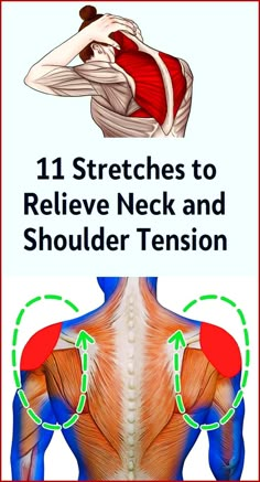 Shoulder Pain Relief, Stiff Neck, Muscle Pain Relief, Neck And Shoulder Pain