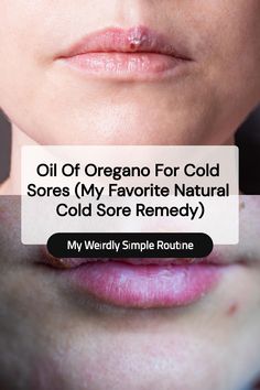 Save this pin to learn how I use oil of oregano for cold sores. If you’re looking for a natural cold sore remedy that packs a punch, this might become one of your favorites, too.