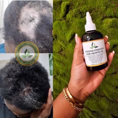 Coffee Hair Growth, Thinning Edges, Natural Hair Care Routine, Black Hair Growth, Coffee Hair, Extreme Hair Growth, Natural Hair Growth Tips, Hair Mask For Growth, Grow Long Hair