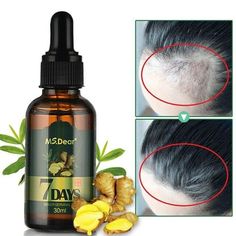 ALL SMART DEALS Aceite Tratamiento Para La Caidad Del Pelo Cabello Calvicie Anticaida Capilar Crecimiento capilar Aceites esenciales Jengibre Aceite germinal Crecimiento capilar rápido Pérdida anticaída Tratamiento de alopecia Suero de crecimiento capilar denso en belleza Especificaciones: Nombre: aceite de crecimiento de cabello de jengibre Contenido neto: 30 ml Ingredientes:  jengibre, ginseng, festival loca, raíz de flor de vellón, aceite de semilla de uva.   Caracteristicas: * El a Ginger Hair Growth, Essential Oil Hair Growth, Hair Growth Secrets, Ginger Essential Oil, Regrow Hair, Hair Growth Serum, Hair Growth Faster, Growth Serum, Growth Oil