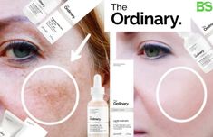 Ordinary Products For Hyperpigmentation, The Ordinary Hyperpigmentation, Ordinary Skincare Products, Best The Ordinary Products, The Ordinary Skincare Guide, Products For Hyperpigmentation, Skin Care Hyperpigmentation, The Ordinary Alpha Arbutin, The Ordinary Skincare Routine