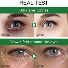 Instant Remove Wrinkles Anti Dark Circles Bags Eye Cream Puffiness Fade Eye Fine Line Tighten Whiten Avocado Eye Cream, Skin Korean, Eye Wrinkle Cream, Dark Eye Circles, Eye Skin Care, Facial Wrinkles, Remove Dark Circles, Under Eyes, Eye Wrinkle