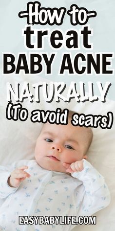 a baby laying on top of a bed with the words how to treat baby acne naturally