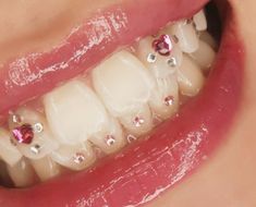 Material: Crystals Swarovski Gems Teeth Jewelry Tooth Gems Women, Teeth Jewelry Cross, Tooth Gems Chandelier, Teeth Jewelry Butterfly, Pink Tooth Gem, Tooth Gems Design, Tooth Gems Bottom Teeth, Tooth Gems Aesthetic, Tooth Gem Placement