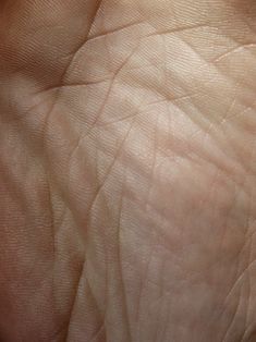 the skin on someone's left hand is white and has very thin lines in it