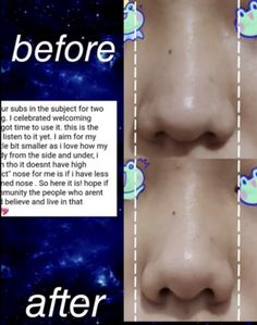 Subliminal Results Desired Face, Before And After Subliminal, Subliminal Nose, Hair Subliminal Results, Nose Subliminal Results, Nose Message, Subliminal Results Before And After