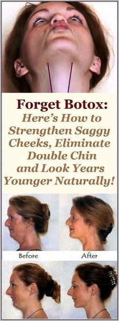 Board name Saggy Cheeks, Být Fit, Chin Exercises, Neck Exercises, Facial Yoga, Face Exercises, Saggy Skin, Facial Exercises, Face Yoga