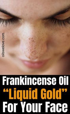 Frankincense Essential Oil Benefits, Frankincense Essential Oil Uses, Essential Oil Beauty, Essential Oils For Face, Essential Oil Diffuser Blends Recipes, Natural Beauty Care, Essential Oils Guide, Essential Oils Herbs, Essential Oils Health