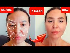 9 FACIAL MASSAGE techniques to stay young - YouTube Face Massage Tutorial, Face Massage Video, Facial Massage Techniques, Face Yoga Exercises