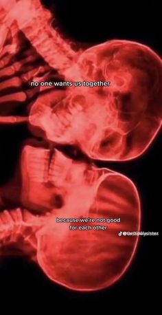 an x - ray image with the words, no one wants us together because we're not good for each other