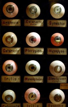 an assortment of different types of eyeballs on display