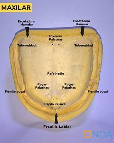 Dentistry Humor, Esthetic Dentistry, Holistic Dentistry, Dentistry Student