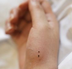 a person's arm with small black dots on it