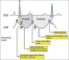 Cardiac Sonography, Cardiology Nursing, Paramedic School, Nursing Mnemonics, Nursing Student Tips, Medical Student Study, Cardiac Nursing, Nursing School Survival, Critical Care Nursing