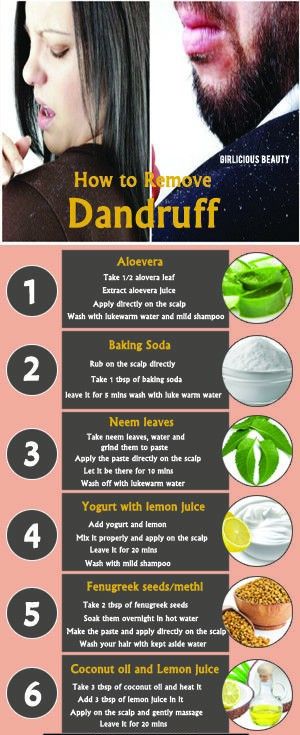 remove dandruff tips Hair Fall Control Tips, How To Remove Dandruff, Hair Mask For Dandruff, Facial Routine Skincare, Homemade Hair Treatments, Dandruff Remedy, Hair Care Remedies, Flaking Skin, Dandruff Treatment