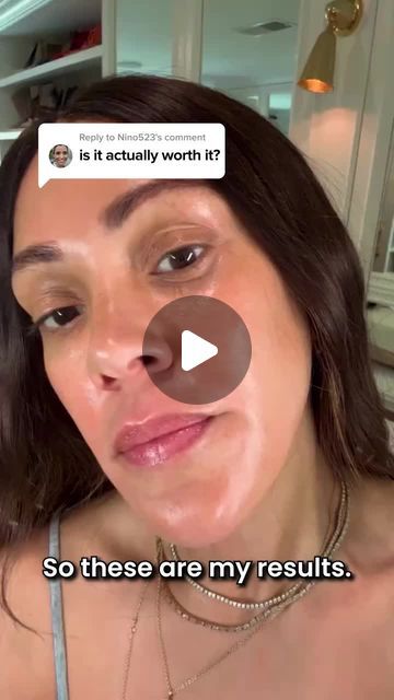 Shani Darden on Instagram: "You know I’m all about a good glow, and my latest skincare secret is out. 

I’ve been obsessed with the Qure Skincare Micro-Infusion System for a while, and I’m so excited to share these instant results with you.

The benefits of microneedling include:
✨increased collagen production
✨smoother, more even skin tone
✨reduced appearance of acne scars, fine lines and wrinkles

Qure has created a device that creates similar results for those of you who are too busy to get a facial. 

Choose one of the two serums provided with the kit to help you get that red-carpet glow✨" Benefits Of Microneedling, Shani Darden, Collagen Production, Too Busy, Even Skin Tone, Skin Tone, So Excited, Skin Tones, Wrinkles