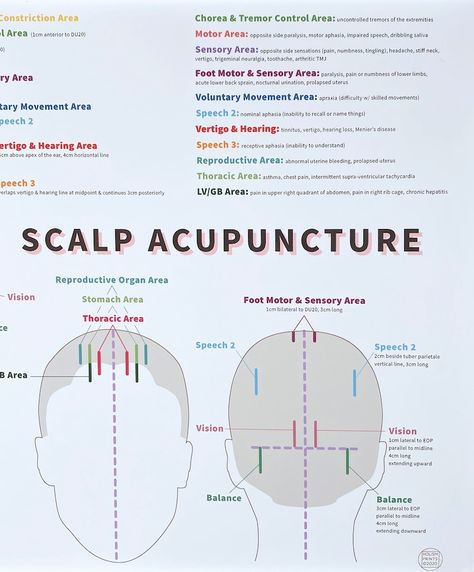 Scalp Acupuncture Print 19 X 13 Chinese - Etsy Turkey Acupressure Points Chart, Acupuncture Charts, Prolapsed Uterus, Acupuncture Points Chart, Throbbing Headache, Head Spa, Reflexology Chart, Sound Therapy, Eft Tapping