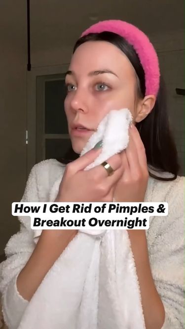 Pimple Pain Vanquished: Dermatologist-Approved Healing Tactics #beauty #beautyhacks #pimple #acne, #pimples #overnightpimples #removepimples #removepimplesovernight https://whispers-in-the-wind.com/combatting-pimples-under-the-skin-expert-tips-and-product-recommendations/?195 Painful Pimple, Pimple Free Skin, Different Types Of Acne, Stubborn Acne, Pimples Under The Skin, Pimples Remedies, Pimples On Face, Skin Bumps, How To Get Rid Of Pimples