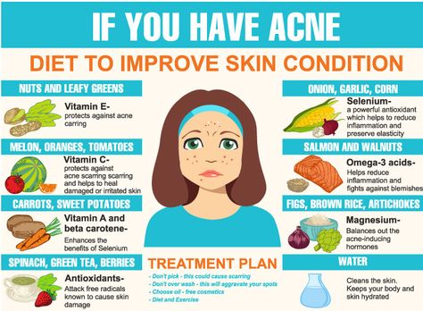 Holistic Tips, Clear Skin Fast, Acne Diet, Skin Care Routine For 20s, Vitamin C Benefits, Clear Skin Tips, Vitamins For Skin, Skin Condition, Acne Remedies