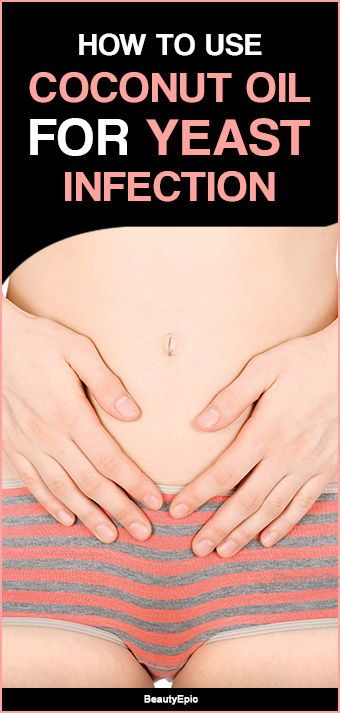 Natural Remedies For Yeast Infection In Women, Antifungal Remedies For Skin, Coconut Oil For Vaginosis, Home Remedies For Yeast Infection Itch, Natural Yeast Infection Remedies, How To Get Rid Of A Yeast Infection Fast, Home Remedy For Yeast Infection In Women, Yeast Infection Remedies Fast At Home, How To Get Rid Of Yeast Infection Fast