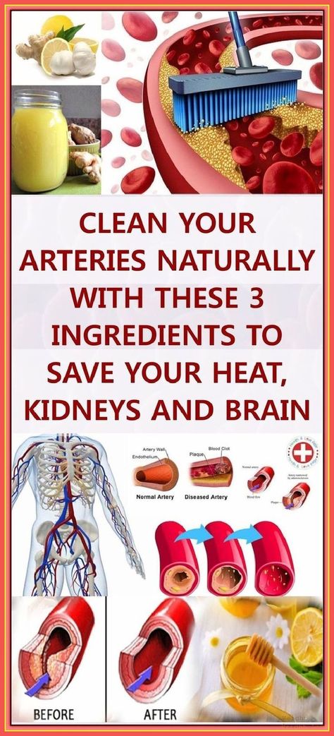 With This Secret Remedy Clean Your Arteries, Lower Cholesterol And Strengthens Your Immune Syst Brain Pin, Clean Arteries, Body Cleansing, Vintage Stereo, Chic Gowns, Ldl Cholesterol, Homemade Remedies, High Cholesterol, Led Lamps