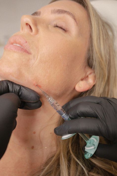 Jaw Filler, More Defined Jawline, Jawline Filler, Defined Jawline, Skin Care Wrinkles, Healthy Advice, Cosmetics Industry, Skin Pores, Anti Aging Treatments