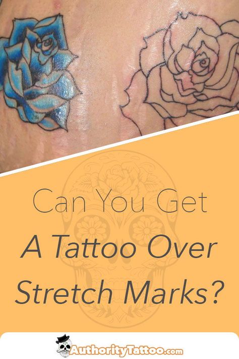 Tattoos To Cover Strech Marks, Strech Marks Tatoos, Tattoos Over Stretch, Tattoo Stretch Mark Cover Up, Tattoo On Strechmark, Stretch Mark Tattoo Cover Up, Tattoo Over Strechmark, Stretchmark Cover Tattoos, Strech Mark Tattoo