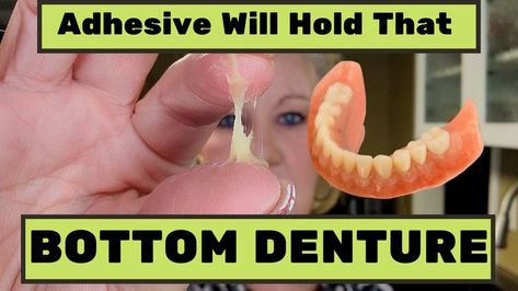 Best Denture Adhesive / Top Denture Adhesives with the STRONGEST HOLD How To Whiten Dentures, How To Clean Dentures, Dental Impression Material, Denture Adhesives, Denture Adhesive, Dental Impressions, Dental Procedures, Dental Supplies, Dental Problems