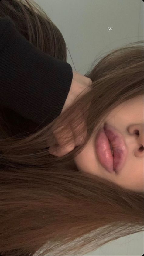 Lips Inspiration, Botox Lips, Lips Photo, Lip Shapes, Juicy Lips, Lip Injections, Perfect Lips, Lip Fillers, Plastic Surgery