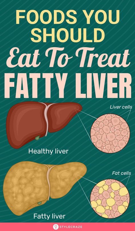 Liver Diet Plan, Healthy Liver Diet, Lung Detox, Baking Powder Uses, Liver Diet, Best Diet Plan, Healthy Liver, Liver Detox, Liver Health