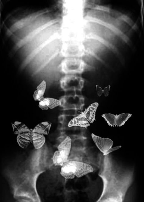 Love is butterflies in my stomach `•.¸¸.•´ ♥☀ `•.¸¸.•´ | Butterflies in my stomach, Daughter of smoke, bone, Give me butterflies Xray Art, You Give Me Butterflies, Butterflies In My Stomach, Iconic Wallpaper, Gothic Aesthetic, Locked Wallpaper, Wedding Destination, Grunge Style, White Photo