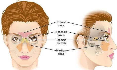 With millions of Americans struggling with chronic sinus issues, it would be helpful to know what causes most of them. Sinus Pressure Points, Sinus Headache Remedies, Relieve Sinus Congestion, Remedy For Sinus Congestion, Sinus Inflammation, Home Remedies For Sinus, Paranasal Sinuses, Maxillary Sinus, Sinus Congestion Relief