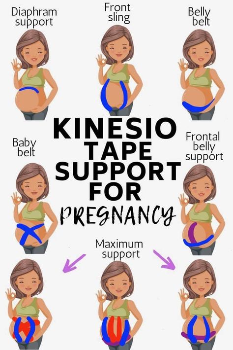 kinesiology tape support for pregnancy Taping Belly While Pregnant, Tape For Pregnant Belly, How To Tape Pregnant Belly, K Tape For Pregnancy, Pregnancy Belly Taping, Kinesio Tape Pregnancy, K Tape Pregnancy, Taping Pregnant Belly, Pregnancy Tape Belly