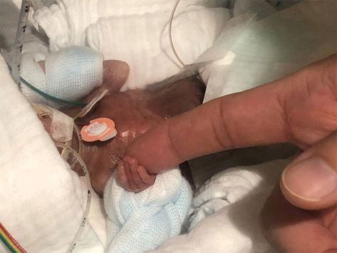 After Spending Months In The Hospital, The World’s Smallest Surviving Premature Baby Has Been Finally Sent Home | Bored Panda Pediatrics Doctor, Emergency C Section, Infant Mortality, Preemie Babies, Baby Hospital, Premature Baby, Small Boy, Baby Tips, Small Baby